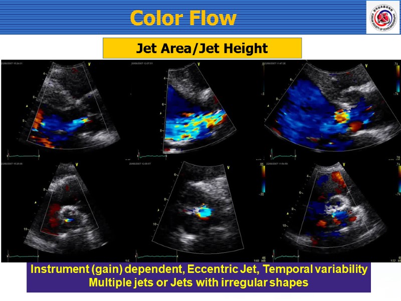Jet Area/Jet Height Instrument (gain) dependent, Eccentric Jet, Temporal variability Multiple jets or Jets